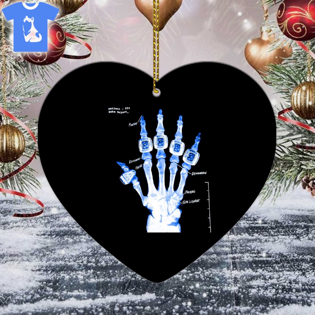 broken not beaten kobe